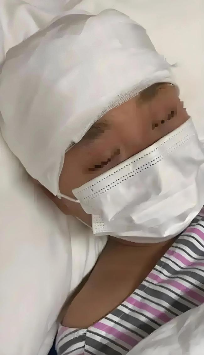 女孩被老师打碎头骨案二审维持原判 双方争议证据鉴定