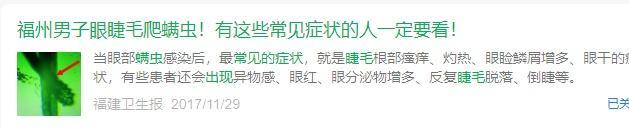 13岁男孩眼痒取出86条螨虫，医生提醒：吃甜食熬夜眼睛或长螨虫 不良习惯助长螨虫滋生