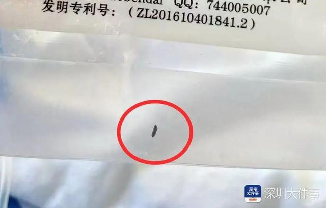 女子拔完牙齿后，头痛难忍！一查嘴里有根“针”