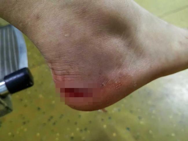 多名孩子在景区水池被瓷砖割伤 游玩变伤痛