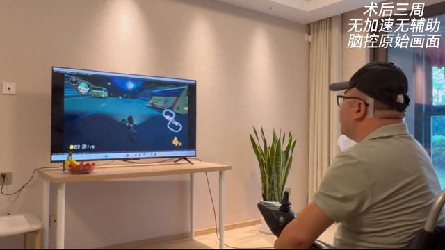 我国成功开展首例侵入式脑机接口临床试验